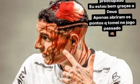 'Estou bem', diz Guilherme Arana após pontos na cabeça se abrirem