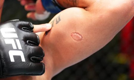 André Mascote levou mordida durante luta no UFC (Foto: Divulgação/Instagram UFC)