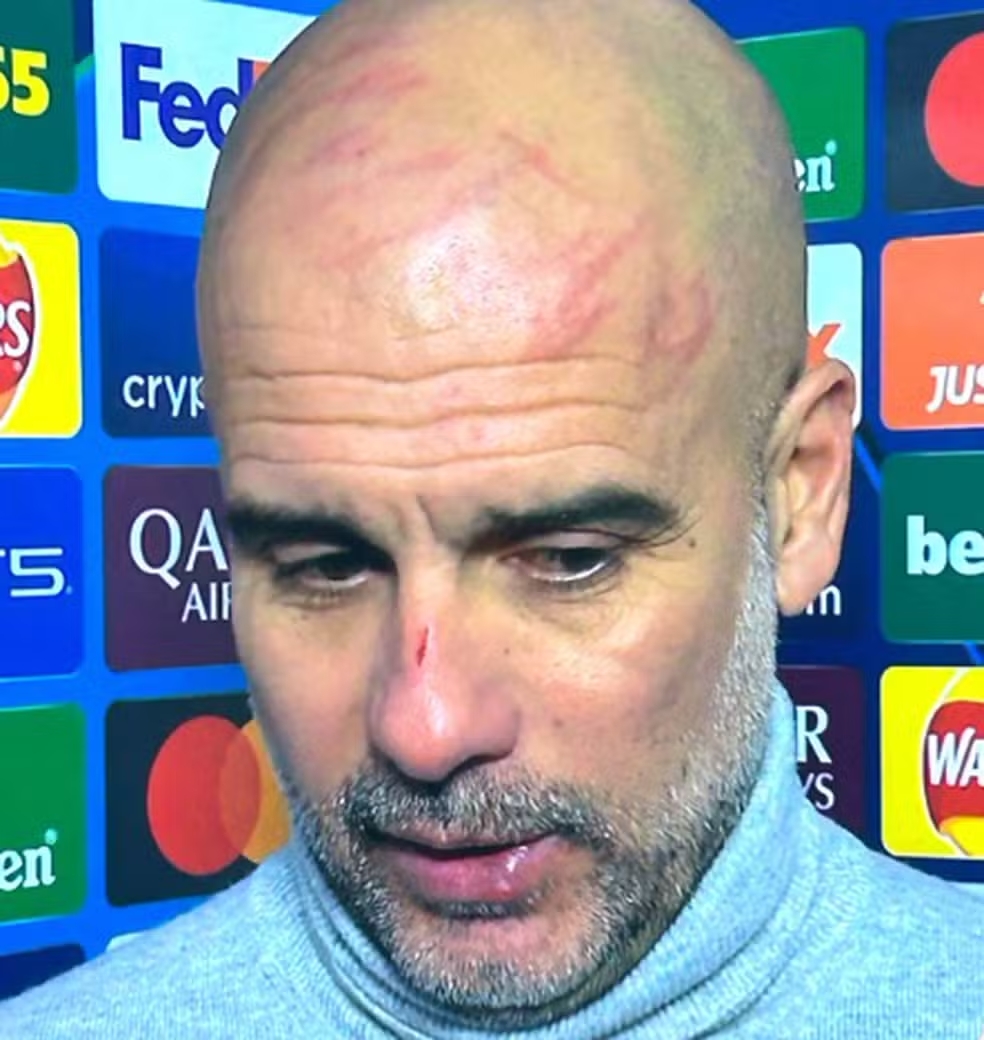 Guardiola. (Foto:Reprodução)